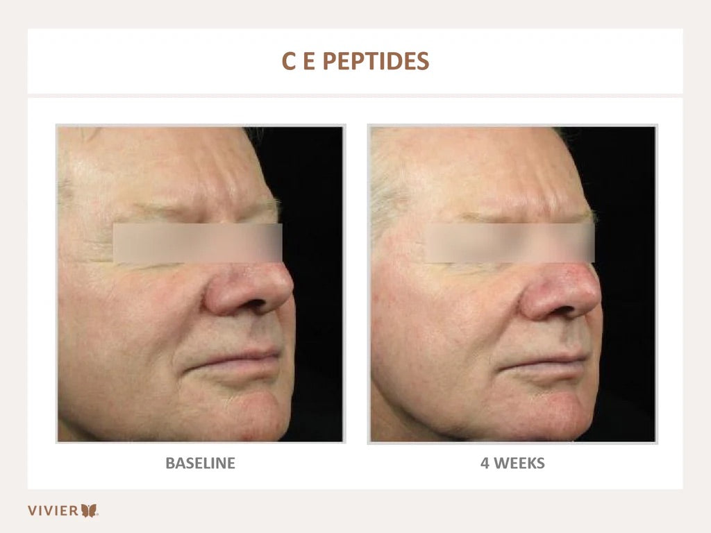 C E PEPTIDES