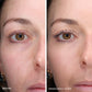 Total Eye 3-in-1 Renewal Care Fair